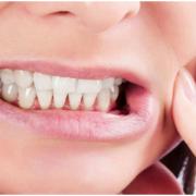 Bruxism-01.jpg